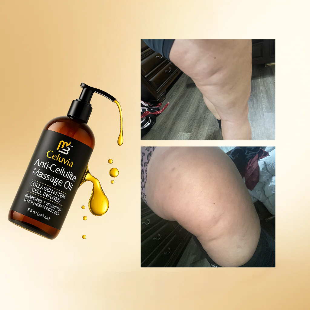 Aceite Anticelulitis Reafirmante Celuvia™